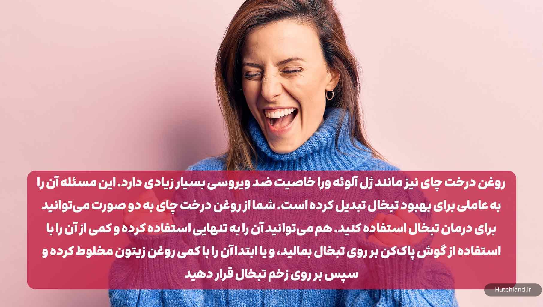 درمان تبخال با روغن درخت چای