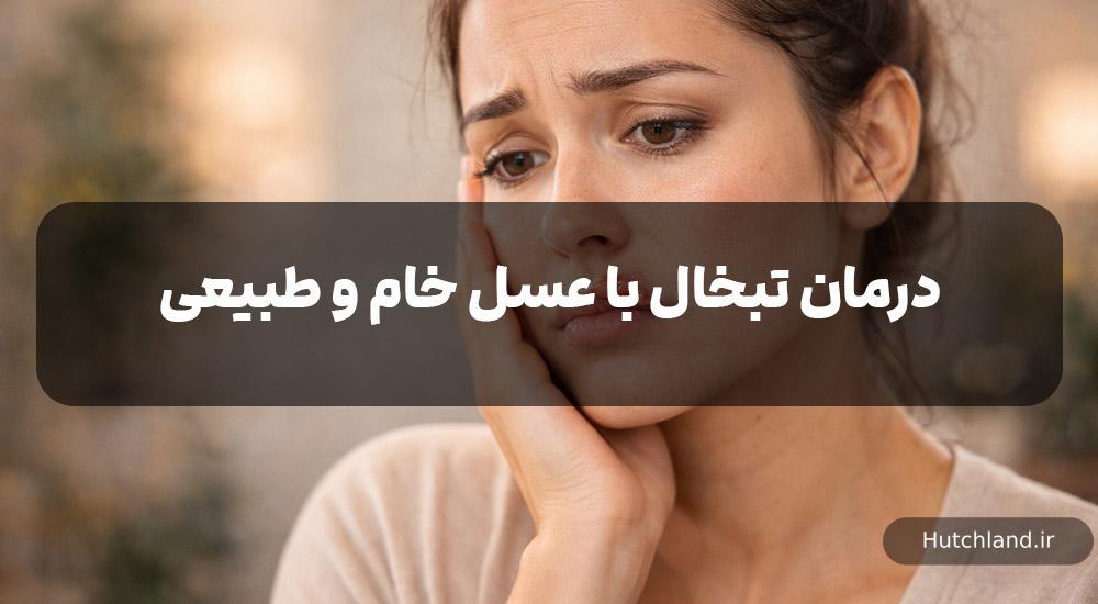 درمان تبخال با عسل