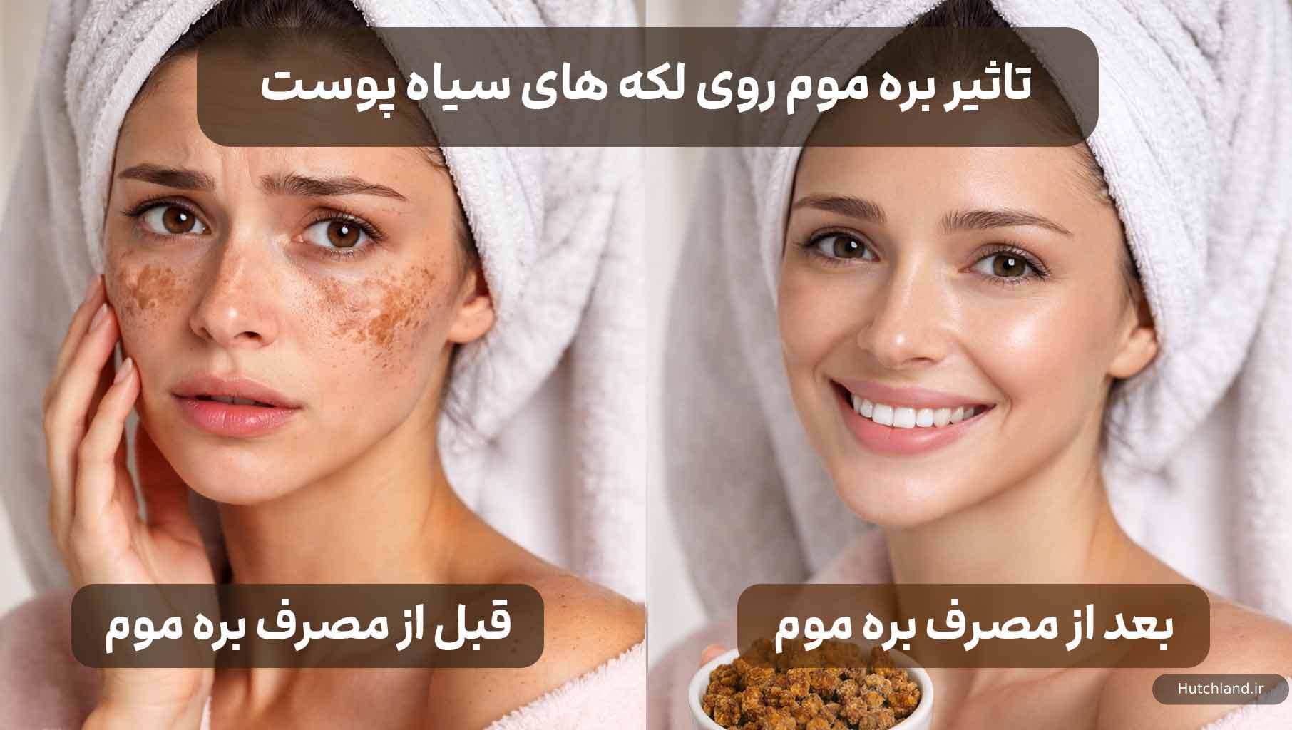 تاثیر بره موم روی لکه های پوستی