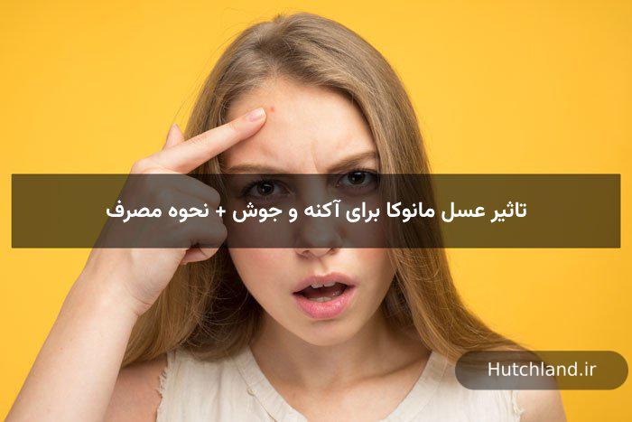 تاثیر عسل مانوکا برای آکنه و جوش