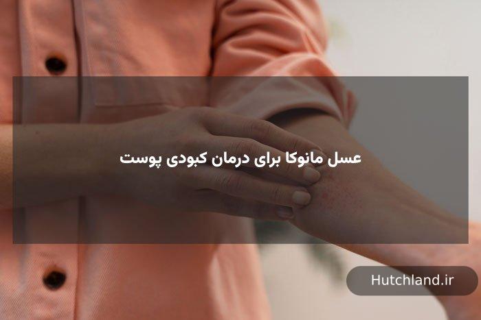 عسل مانوکا برای درمان کبودی پوست