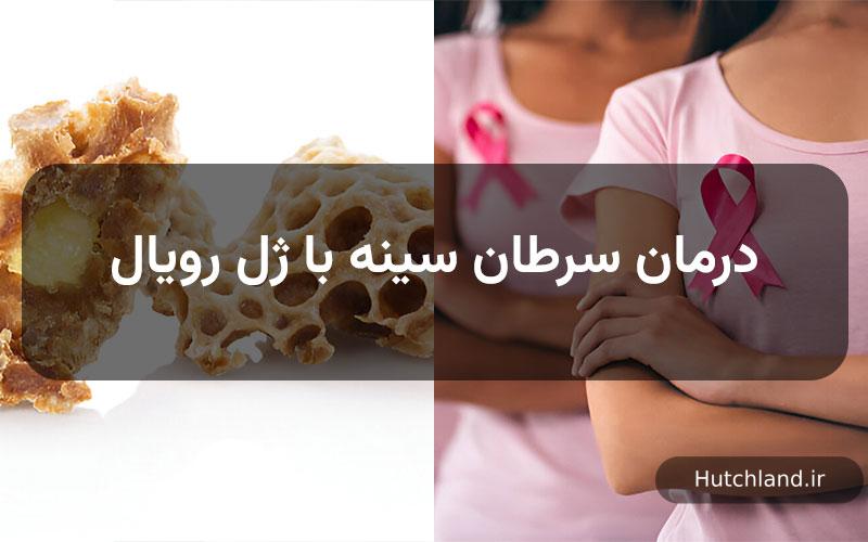 درمان سرطان سینه با ژل رویال