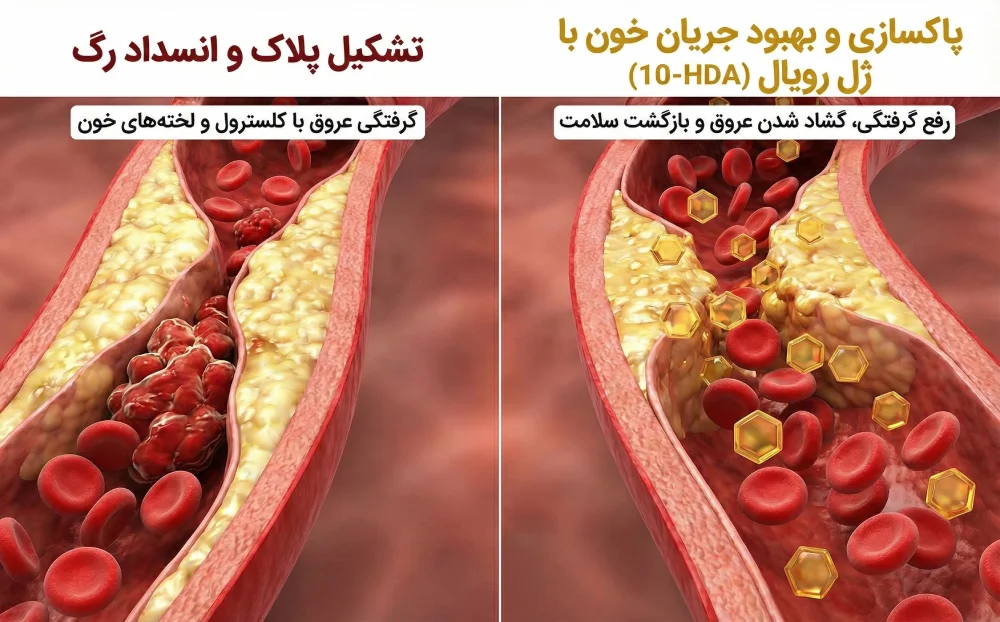 تاثیر ژل رویال بر باز کردن عروق مغزی و پیشگیری از سکته ایسکمیک