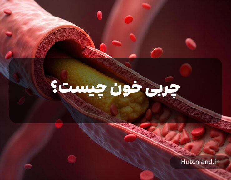 چربی خون چیست؟