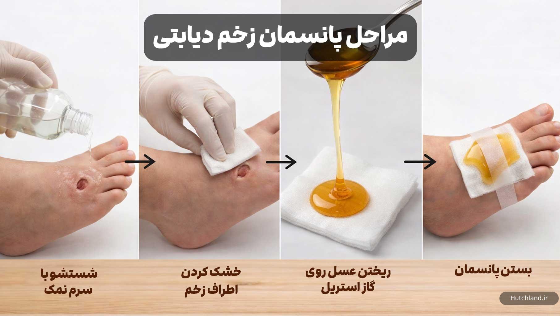 طریقه استفاده از عسل برای زخم