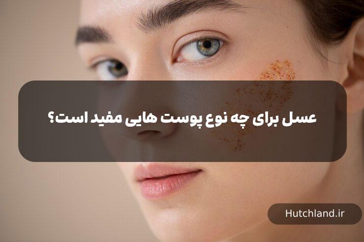 عسل برای چه نوع پوست هایی مفید است؟