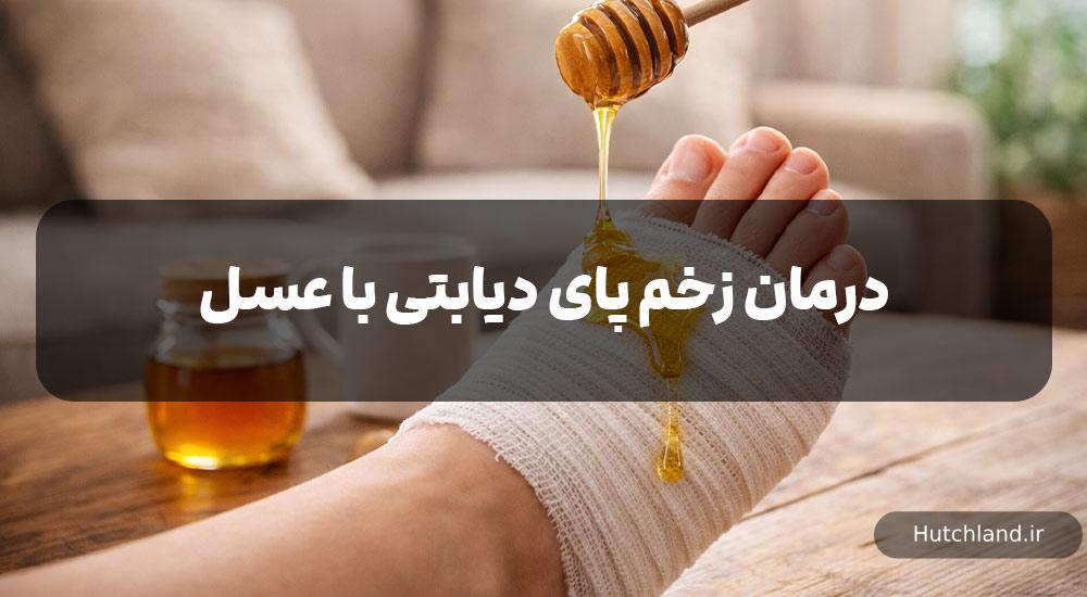 درمان زخم پای دیابتی با عسل