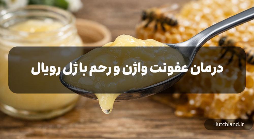 درمان عفونت واژن و رحم با ژل رویال
