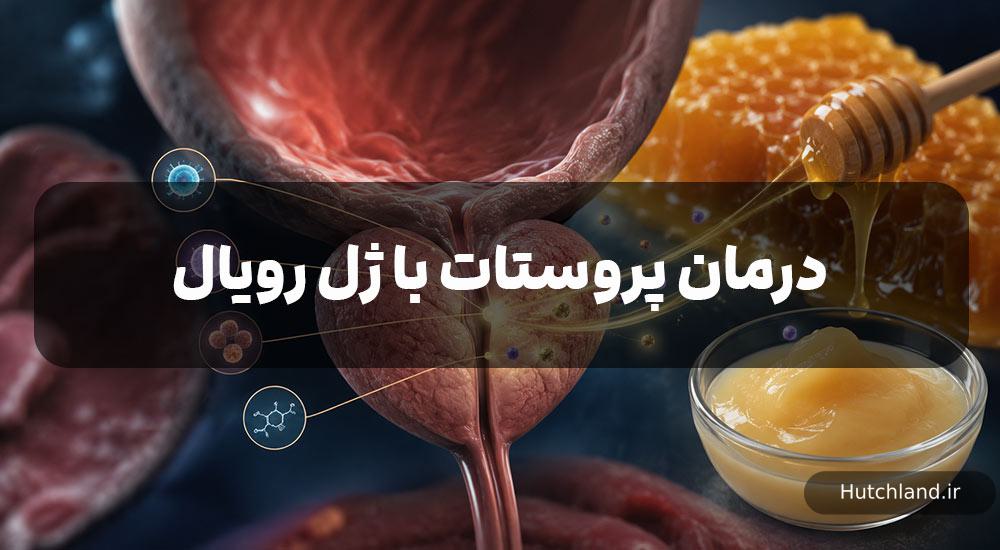 درمان پروستات با ژل رویال