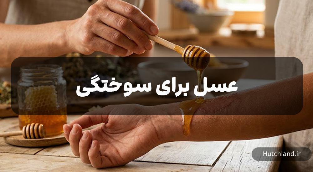 عسل برای سوختگی