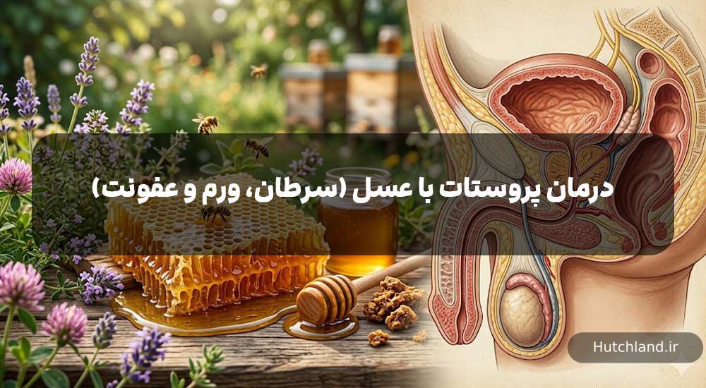 درمان پروستات با عسل